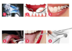 Picture of Home Use Dental Tools Electric Teeth Cleaner With Led Screen